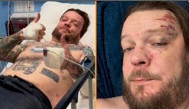 Playa del Carmen: actor de USA no puede pagar altos costos médicos